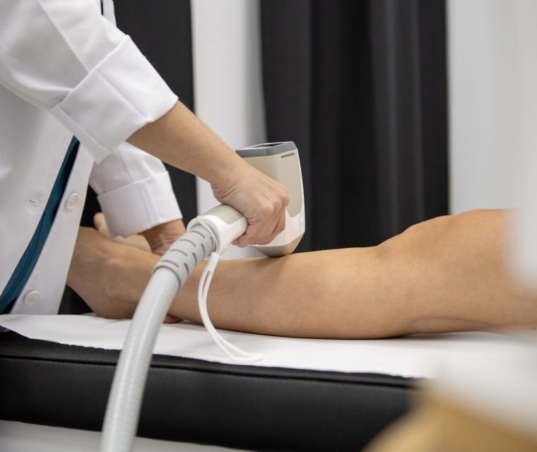 depilación laser