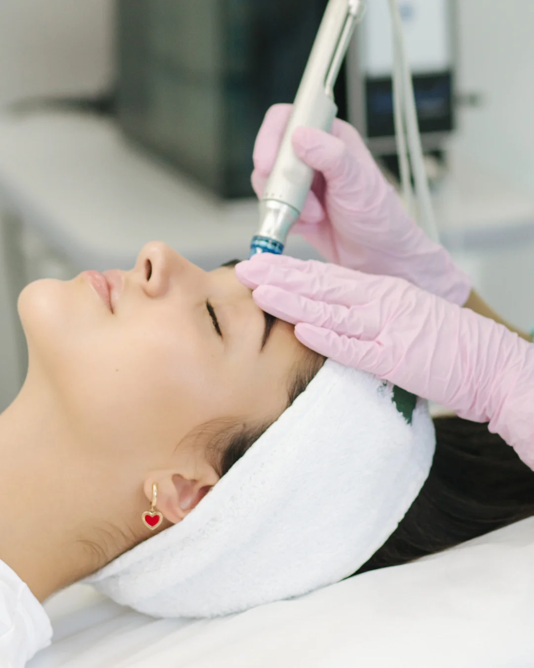 HYDRAFACIAL tratamiento en castellón