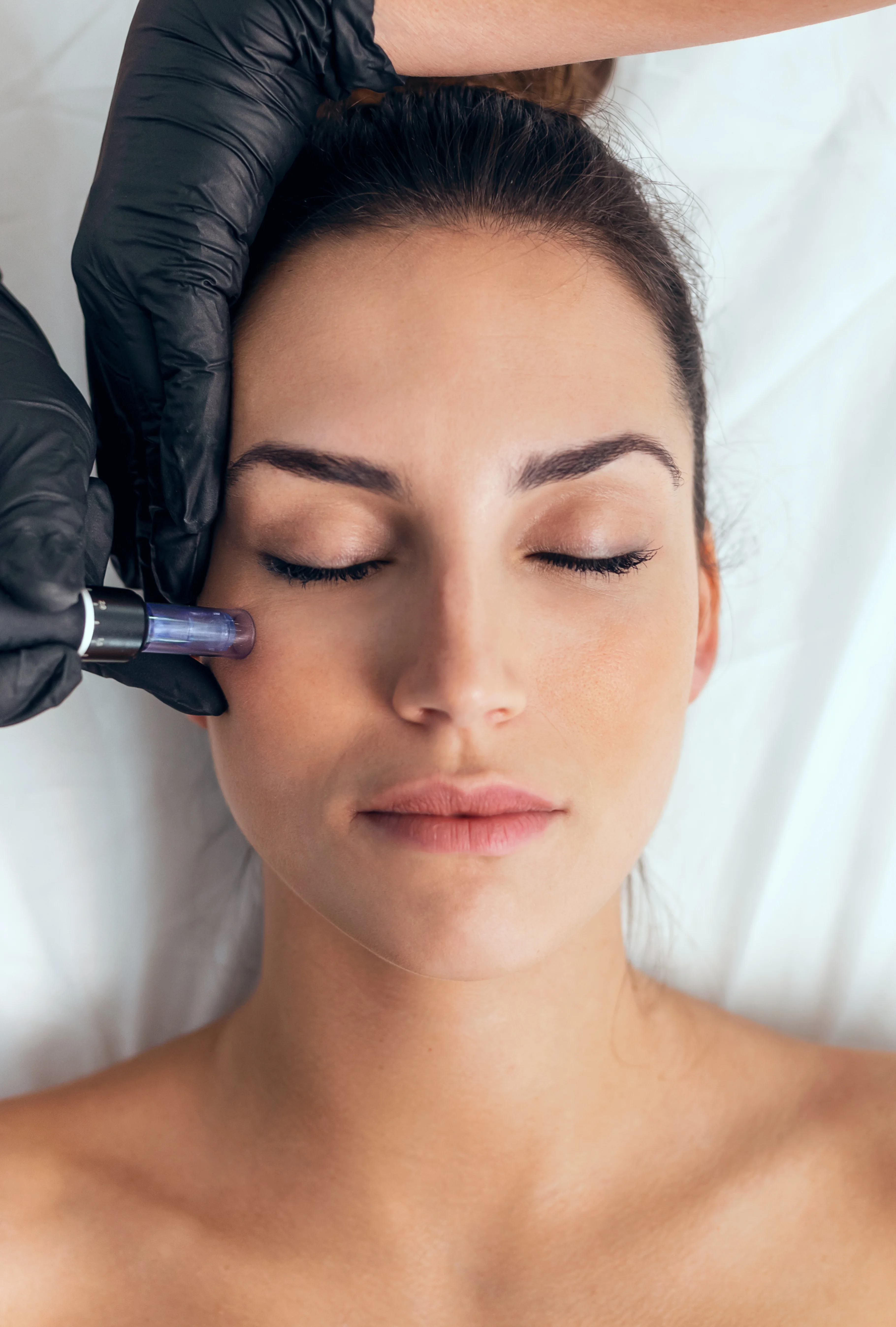 dermapen vall d'uixo
