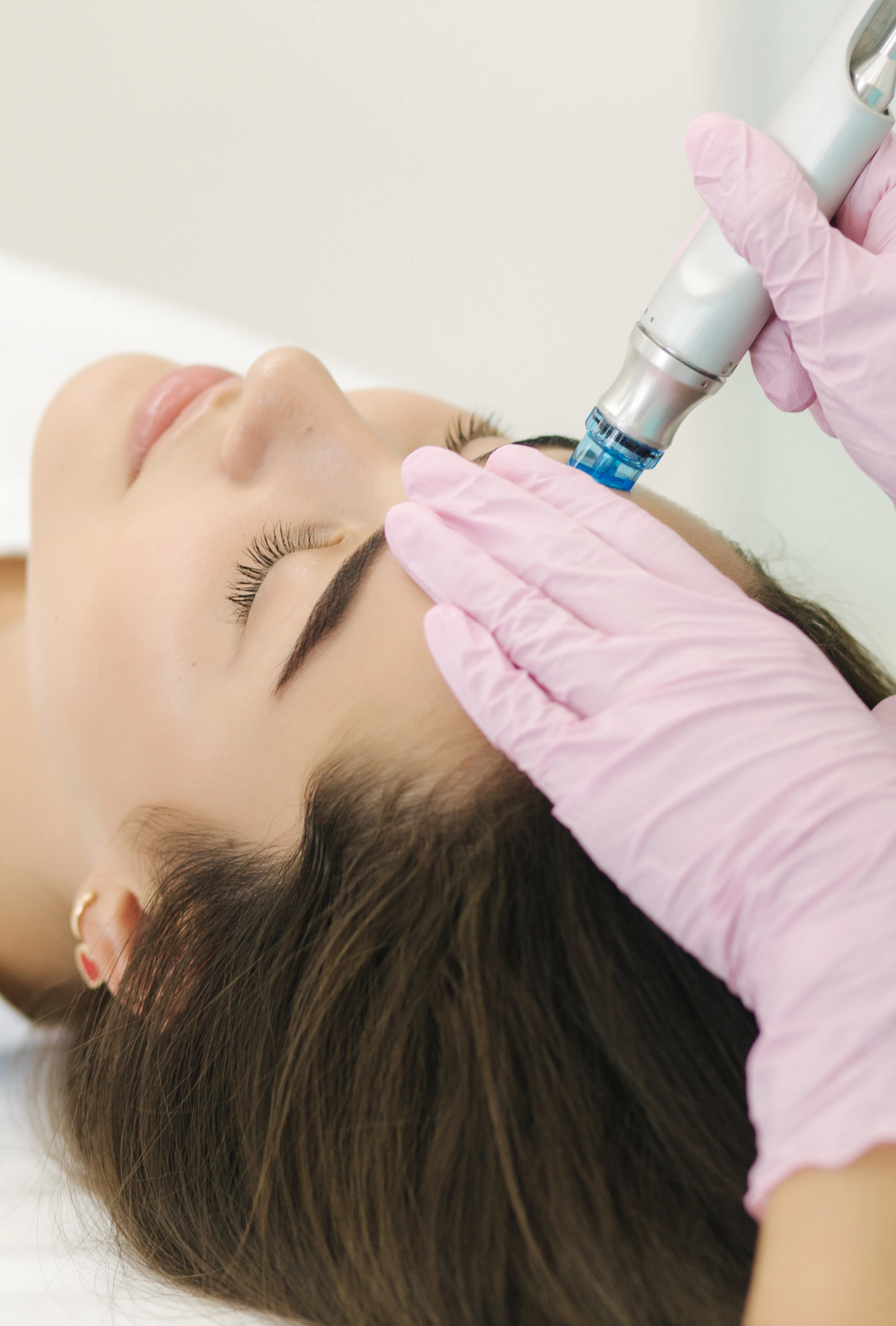 HYDRAFACIAL tratamiento en castellón